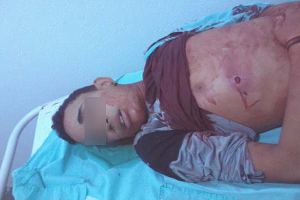 Menor acusado de vários delitos em São José da Laje é executado a tiros em praça pública