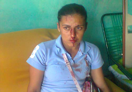 Mãe e filha são agredidas por dupla de mulheres enciumadas