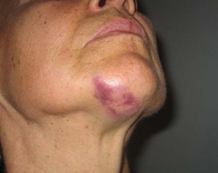 Com ciúmes, homem joga pedra no rosto da esposa após chamá-la para ir na casa de amigos