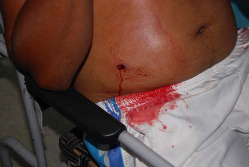 Tiroteio deixa três feridos na ‘Vargem da Vila’ em Marechal; um está desaparecido