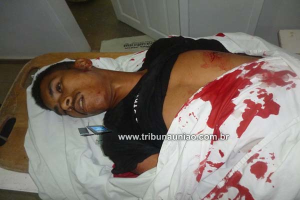 Encapuzados invadem casa e matam jovem na periferia de São José da Laje