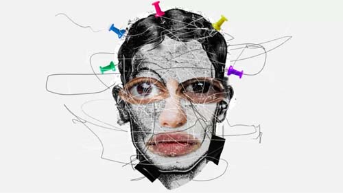 Dismorfia corporal: 'preocupação com meu aspecto físico não me deixava viver'