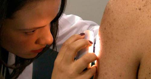 Doença rara que afeta povoado de Goiás tem sua origem traçada à colonização europeia