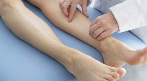 Mutirão realizará 300 atendimentos para doenças vasculares