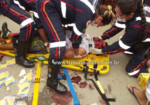 Motocicleta de locutor bate em caminhão parado e machuca condutor 