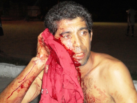 Confusão quase acaba em morte por conta de cigarro