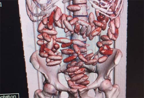 Dois passageiros são presos no Aeroporto do Recife transportando 214 cápsulas de cocaína no estômago