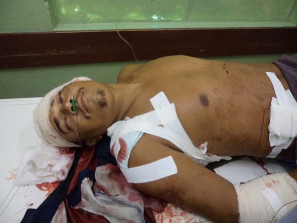 Foragido do Presidio São Leonardo é baleado na periferia de União dos Palmares