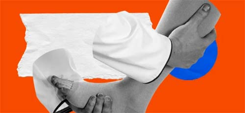 Linfedema: O Efeito Colateral Esquecido do Câncer que Afeta Milhões de Pessoas