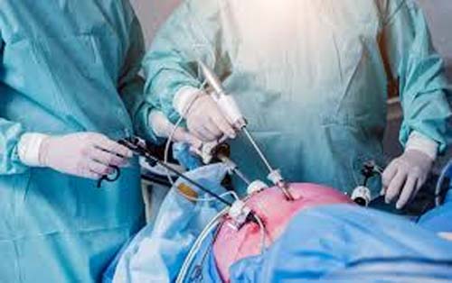 Cirurgia para endometriose: quando é a melhor opção para o tratamento?