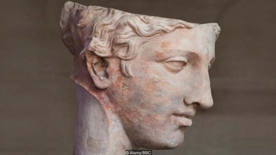 Por que ainda não sabemos tudo o que gostaríamos sobre a enxaqueca