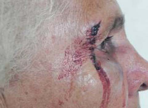 Filho é preso após agredir mãe de 85 anos 