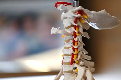 Escoliose pode levar a problemas respiratórios e cardíacos