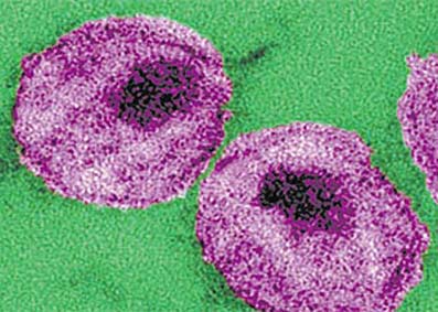 Estudo revela como HIV se esconde dos remédios anti-Aids 