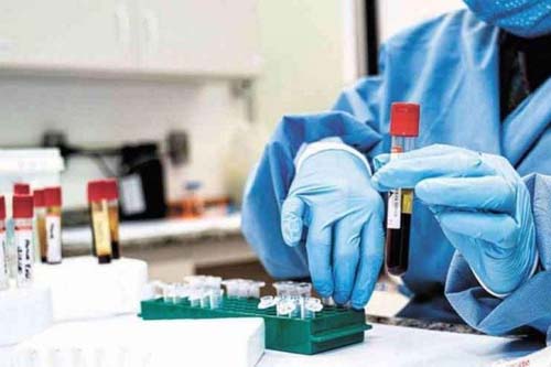 Cientistas identificam 290 variantes genéticas ligadas à menopausa