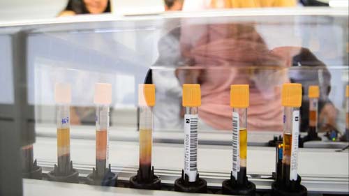 Cientistas desenvolvem exame capaz de detectar câncer em 10 minutos