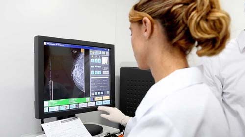 Femama alerta sobre mamografias após vacina contra covid-19