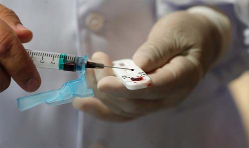 Exame de sangue que detecta Alzheimer chega ao Brasil