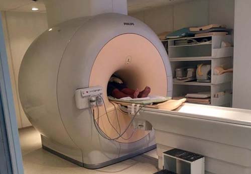 Usuários do SUS agora contam com ressonância magnética computadorizada em São Miguel dos Campos