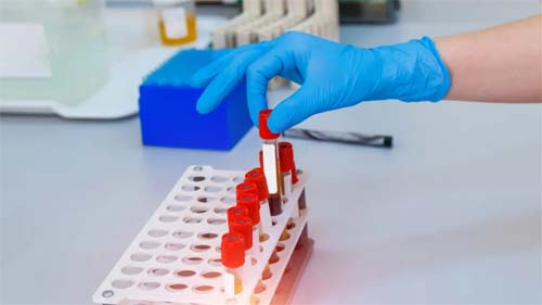 Testes Cruciais que Podem Preservar Sua Saúde