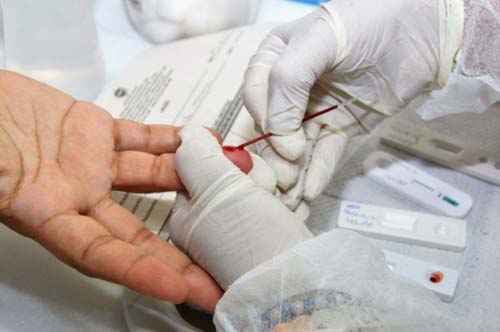 Sesau lança campanha para estímulo à testagem rápida de HIV