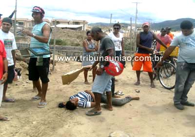 Caçamba atinge motocicleta e causa fratura exposta em perna de jovem