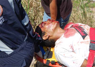 Homem vira “peneira” ao ser atingido por dez tiros