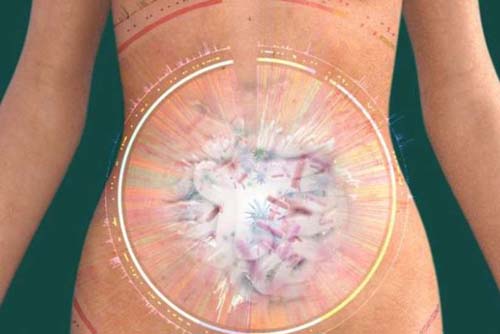 Flora intestinal desequilibrada favorece o surgimento de câncer