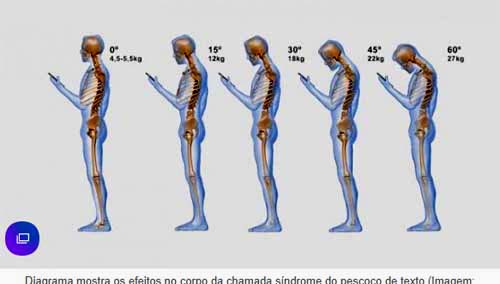 Cientistas acreditam que uso de smartphones está alterando o formato do crânio