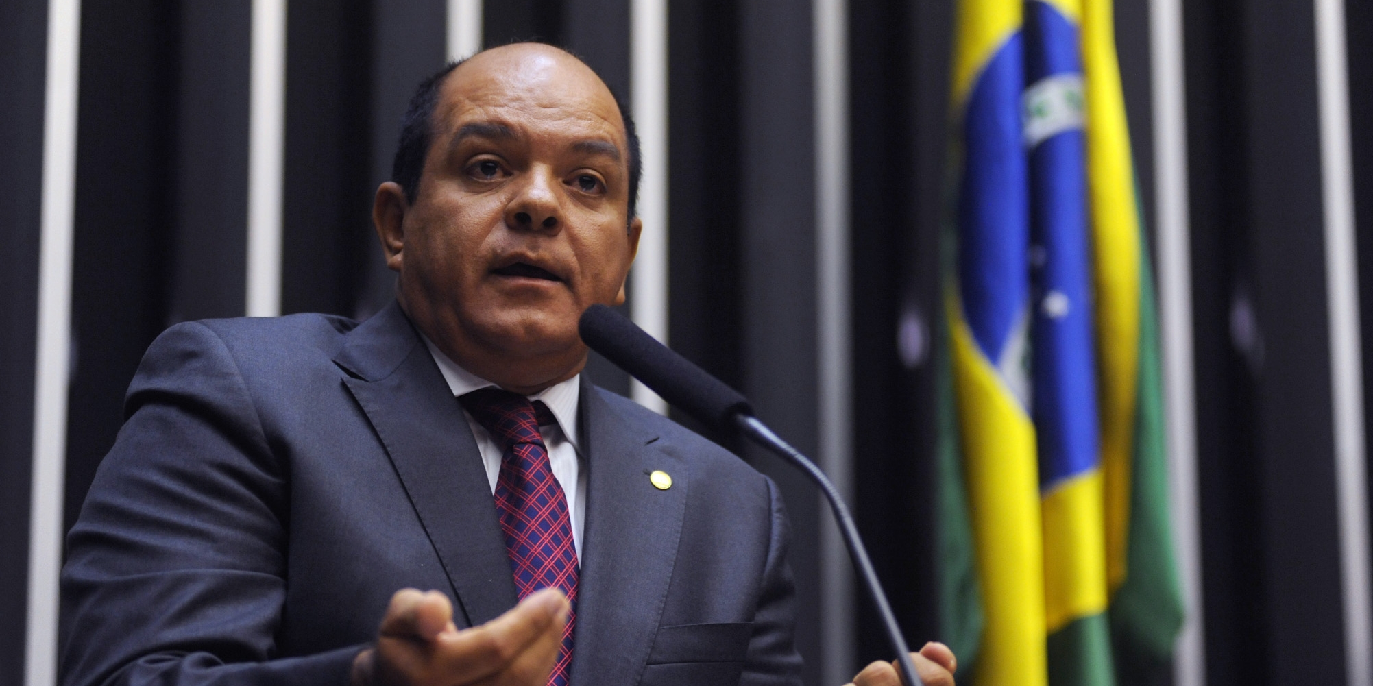 Câmara aprova dispensa de carência para benefícios do INSS a portador de lúpus ou epilepsia