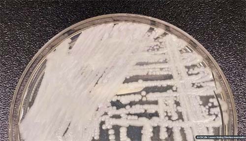 Anvisa confirma novo caso do superfungo Candida auris