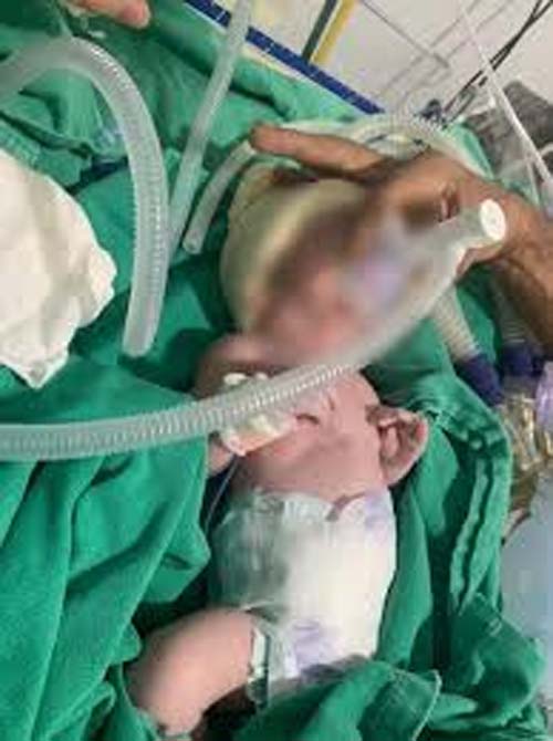 Mulher grávida é entubada após companheiro tentar matá-la em Craíbas
