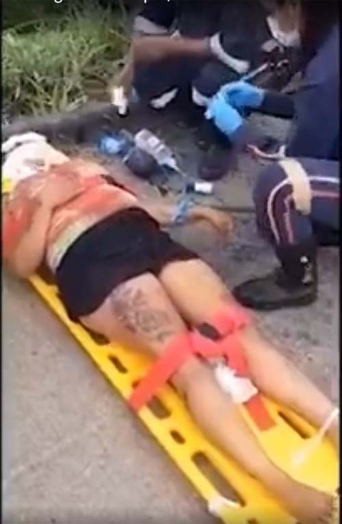 AL: gestante fica presa às ferragens após colisão entre carros