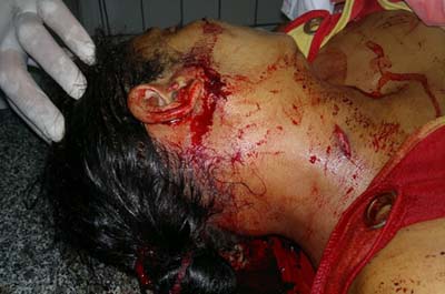 Mulher é assassinada a tiros no Conjunto Mutirão em Marechal Deodoro 