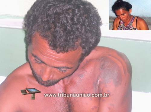 Inusitado: em Branquinha, mulher joga óleo fervendo em companheiro e se reconciliam na Regional de União