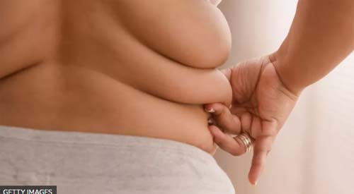 Por que acumular gordura corporal nos deixa mais vulneráveis à covid-19