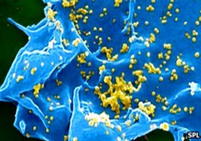 Novo vírus fatal de gripe 'pode ser transmitido por contato humano'