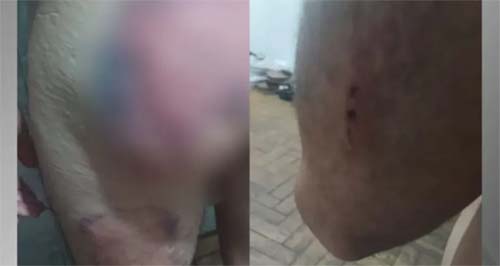 Exército expulsa seis militares acusados de torturar soldado de 19 anos