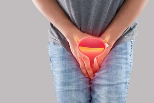 Hematúria é o sinal mais comum de câncer de bexiga