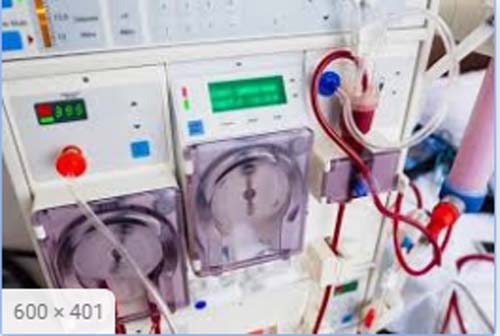 Entenda como é feita a hemodiálise
