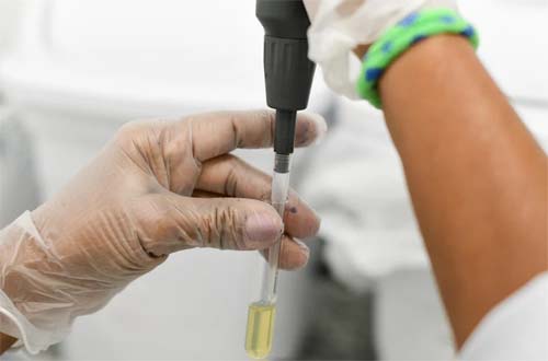 Hematologista do Hemoal orienta os pais sobre os sinais que a criança com hemofilia apresenta