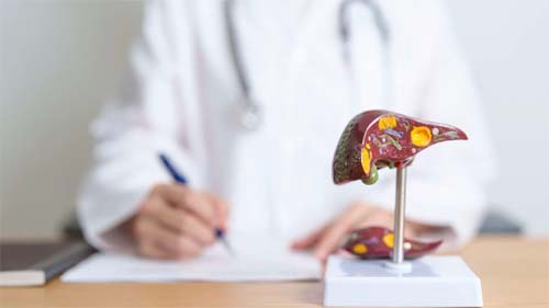 Hepatite C: veja sintomas e como ocorre a transmissão dessa doença silenciosa