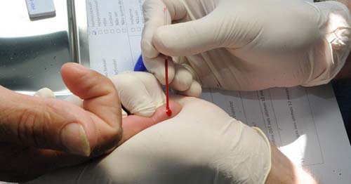 Hepatites B e C, mal-curadas, podem se tornar doenças crônicas