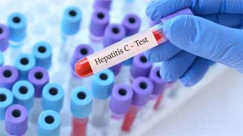 Hepatite C pode estar ligada a transtornos mentais, diz novo estudo
