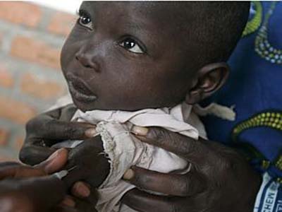 Vacina da hepatite A permanece eficaz por 10 anos