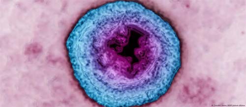 OMS: Herpes genital afeta 1 em cada 5 adultos e custa bilhões aos sistemas de saúde