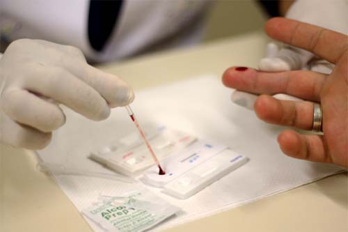Brasil ainda não cumpre todas as metas para fim do HIV, aponta relatório da ONU