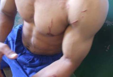 Mulher agride marido com golpes de tesoura por causa de “troco errado”