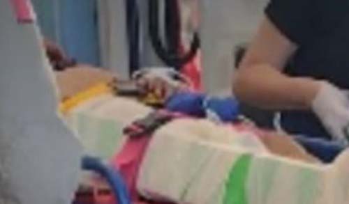 Homem leva tiro e sofre fratura em queda após ser flagrado em telhado de residência na cidade de Arapiraca