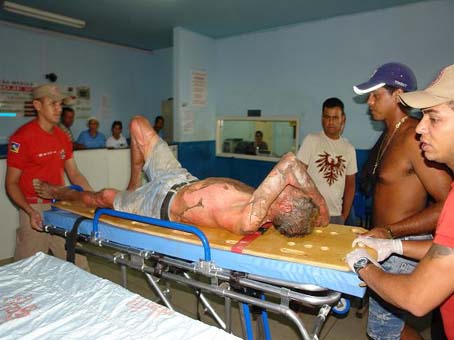 Mãe manda atear fogo no corpo do próprio filho em Penedo